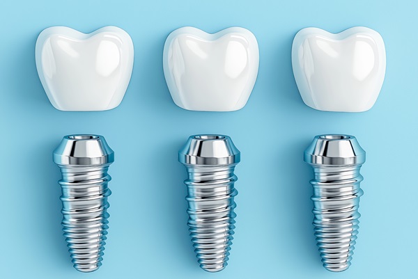 Can Dental Implants Replace Molar Teeth?