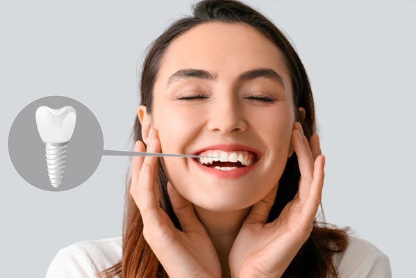 Single Tooth Replacement Options